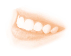 Implantate sind knstliche Zahnwurzeln aus Titan, die in den zahnlosen Kieferabschnitt whrend einer kurzen Operation eingeschraubt werden und als Verankerungen fr Brcken und Prothesen dienen. Die Betubung erfolgt rtlich. Nur selten ist eine Vollnarkose erforderlich. Die Implantatversorgungen werden seit 2005 von den gesetzlichen Krankenkassen bezuschusst und sind somit auch gesetzlich versicherten Patienten zugnglich. Etwa 85%, der im Unterkiefer gesetzten Implantate sind nach 10 Jahren noch in Funktion. Im Oberkiefer sind es ca. 65%.